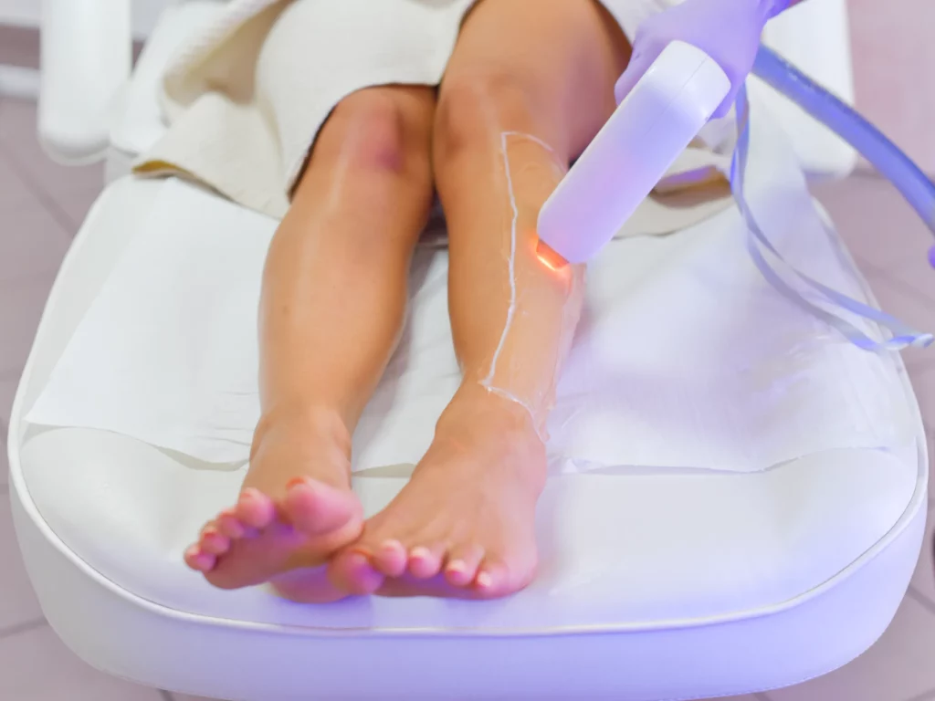 Laser Treatment Best Laser Hair Removal Boca Raton FL